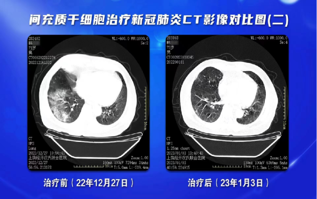 如图片无法显示，请刷新页面